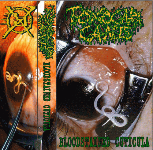 Toxocara Canis : Bloodstained Cuticula Toxocara Canis : Bloodstained Cuticula